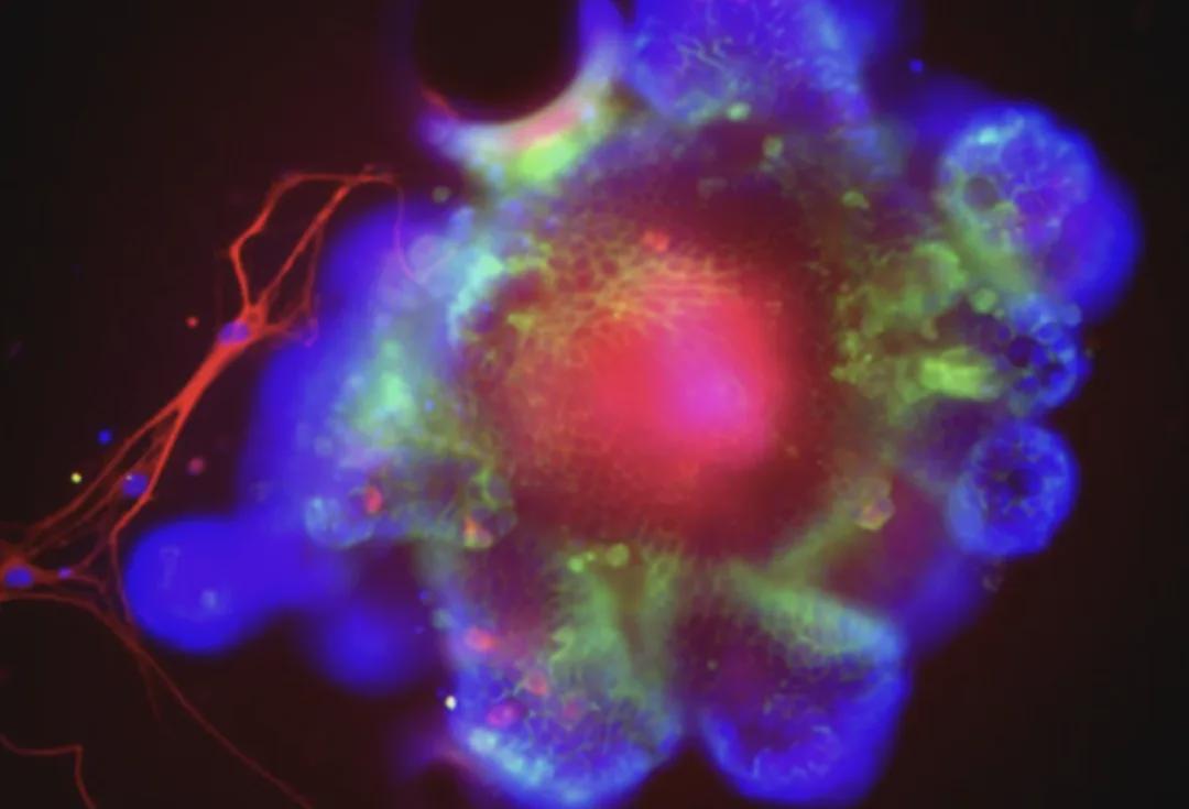 kaiyun-《自然》重磅！刚刚，终于发现酒精伤肝底层逻辑了，你还敢喝吗？